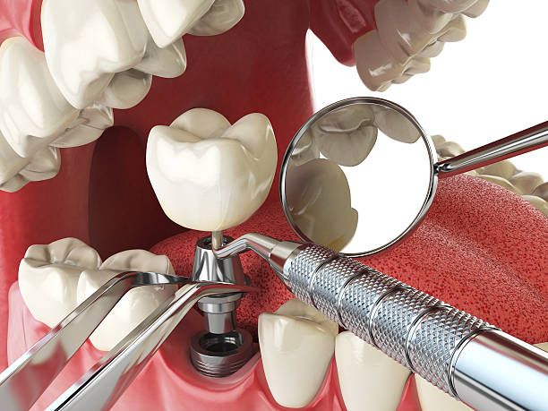 Best Tooth Infection Emergency Dentist  in Pinconning, MI