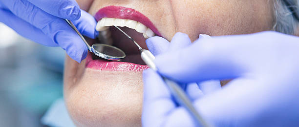Best Urgent Tooth Repair  in Pinconning, MI